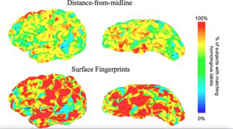 four scans of a brain